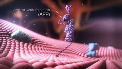 Demenz Amyloid-Vorläuferprotein