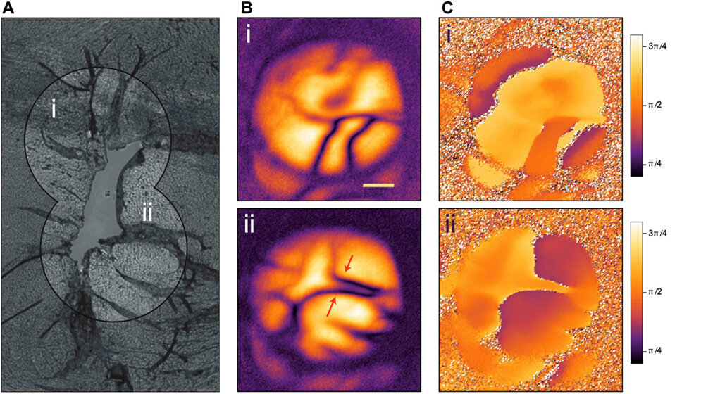 Histologieprobe eines Mausherzens