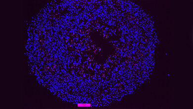 programmierter Zelltod