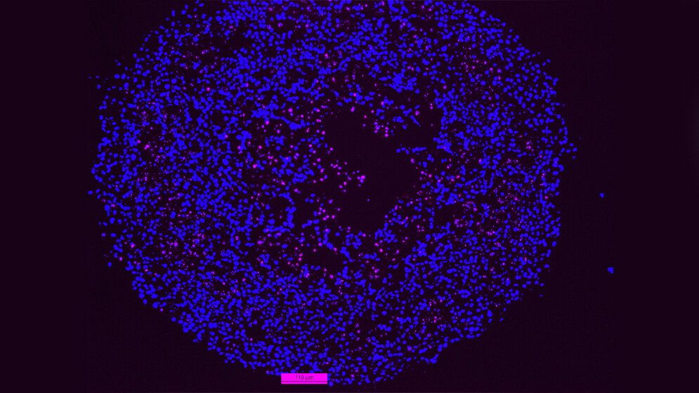 programmierter Zelltod