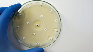 Foto von einer Agarplatte mit Antibiotika-Resistenztest (Antibiogramm)