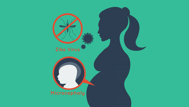 Zikavirus und Schwangerschaft