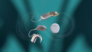  Cochlear™ Nucleus® Nexa™ System