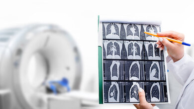 Medizinische Fachkraft zeigt mit einem Stift auf CT-Scans der Lunge, im Hintergrund ein unscharfes CT-Gerät.