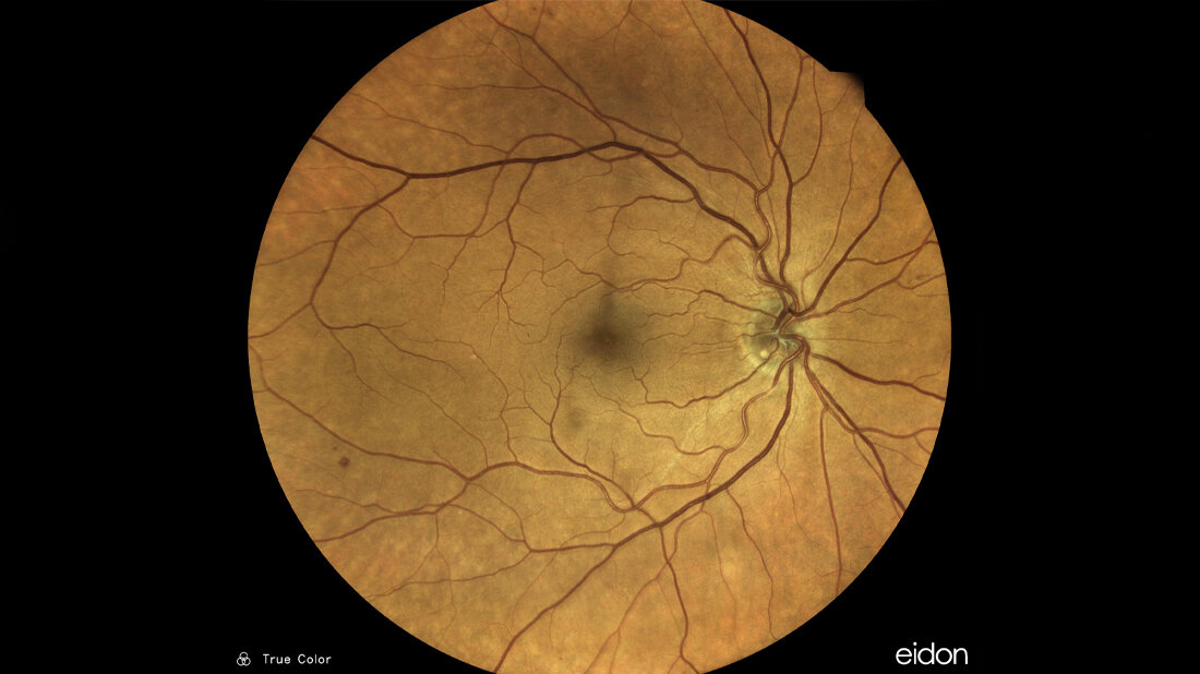 Augenhintergrund des Menschen