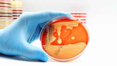 MRSA.jpg MRSA