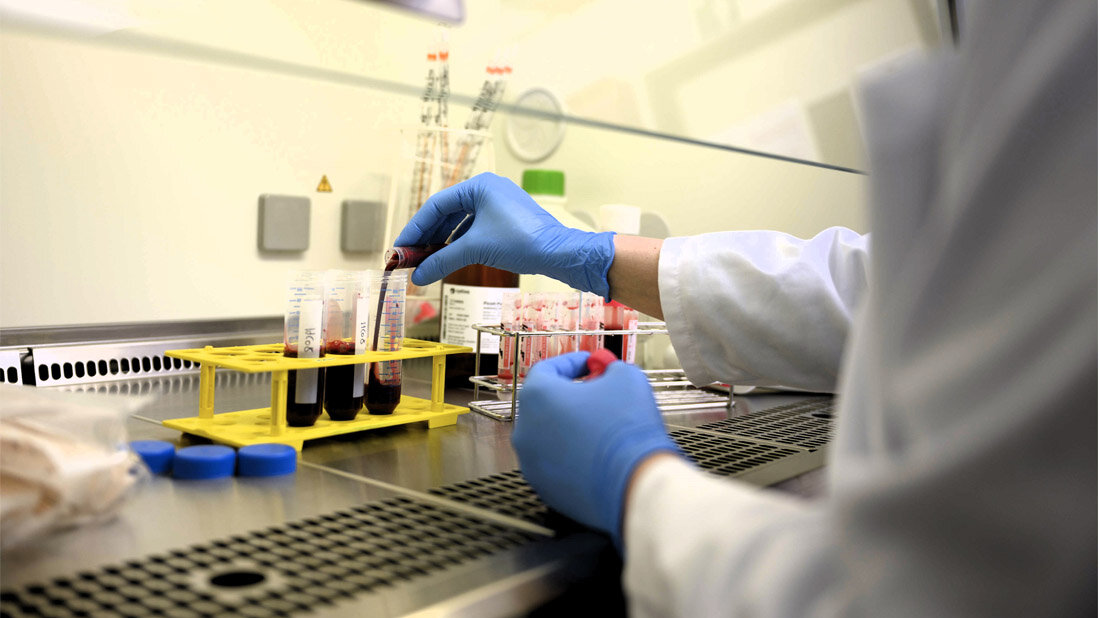 Immunzellen_anreichern_und_analysieren.jpg Mithilfe einer von Prof. Petra Bacher und Prof. Alexander Scheffold entwickelten Methode konnten die Forschenden aus der großen Menge verschiedener Immunzellen im Blut gezielt die seltenen autoreaktiven Immunzellen anreichern und analysieren.