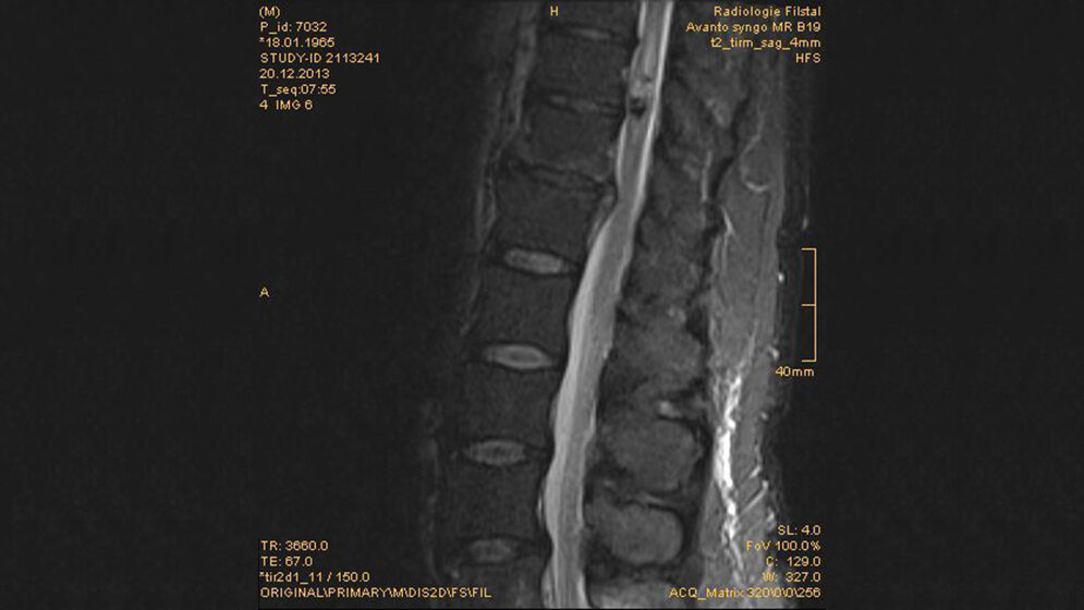 Schnittbilddiagnostik der Wirbelsäule