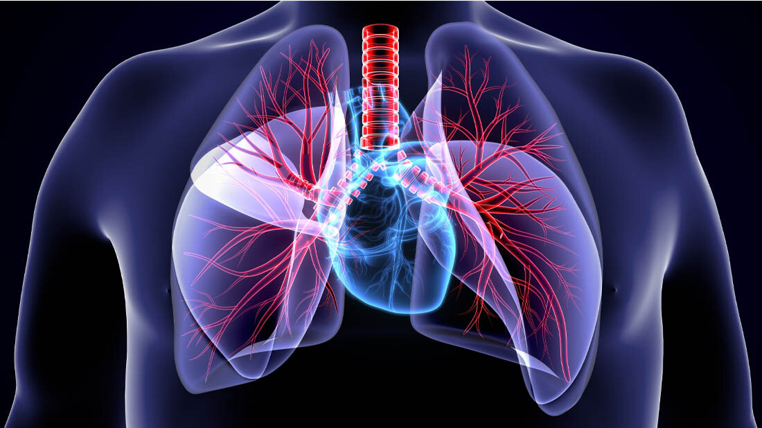 CTEPH und gleichzeitig eine Linksherzerkrankung