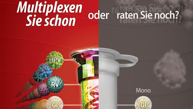 seegene_Industrie.jpg PCR-Diagnostik