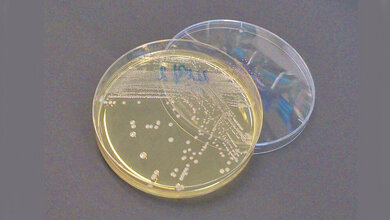 Multiresistente Bakterien 