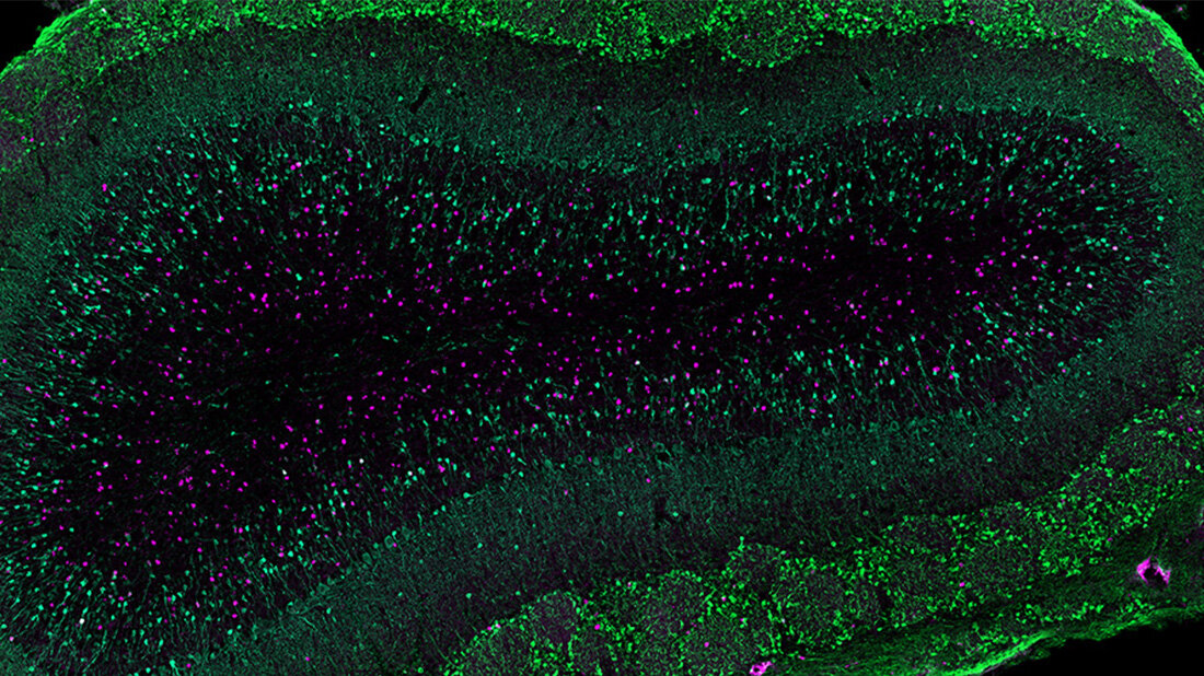 Schwangerschaft verändert Gehirn, Mäusestudie