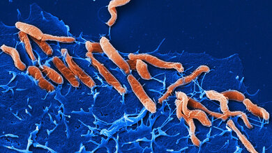 Helicobacter pylori 