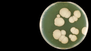 Die Rolle der Sprosspilze in der Medizin (Teil 1)