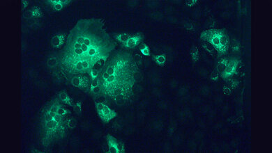 Affennierenzellen, die mit dem MERS-Coronavirus (grün) infiziert sind