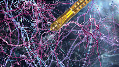 Illustration_des_Miniatur-MRT_whitehoune_stock_adobe_com_MPI_fuer_biologische_Kybernetik_Uni_Stuttgart_Bildmontage_Martin_Voetsch.jpg Miniatur-MRT