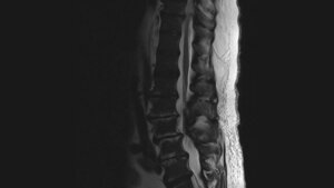 Schnittbilddiagnostik der Wirbelsäule (4.18)