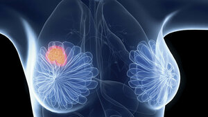 Genexpressionsanalysen (Teil 4.2)