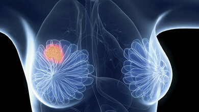 Genexpressionsanalysen (Teil 4.2)