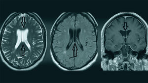 Anomalien und Normvarianten