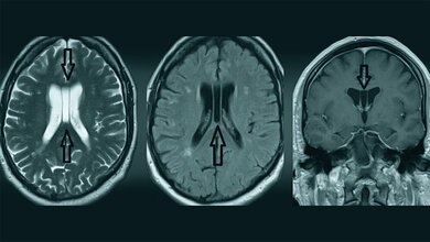 Anomalien und Normvarianten