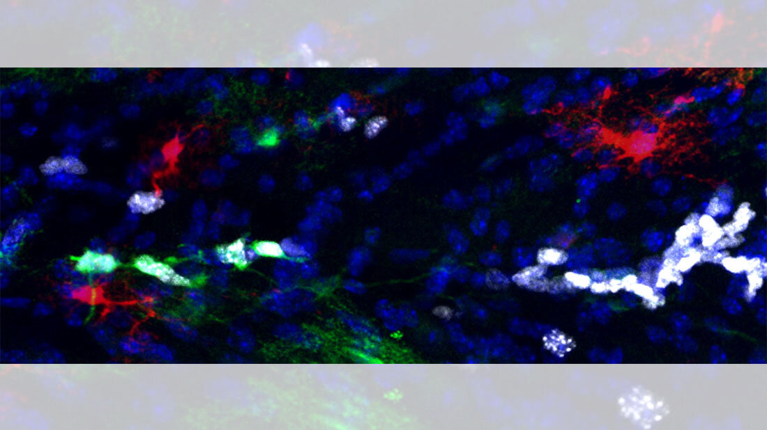 Astrozyten_01.jpg Proliferative Astrozyten in der weißen Substanz des murinen Gehirns.
