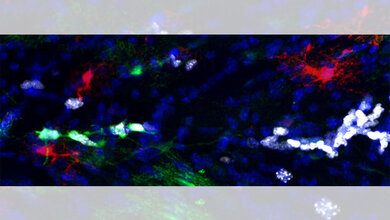 Proliferative Astrozyten in der weißen Substanz des murinen Gehirns.