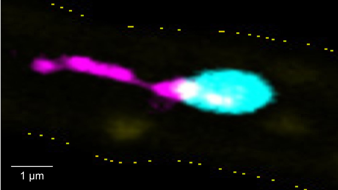 Intravitalmikroskopische Aufnahme aus der Leber eines Mausmodells: Ein Thrombozyt (türkis) haftet an der entzündeten Gefäßwand (gelb gestrichelt) und schnürt einen langen, fadenförmigen Membranfortsatz ab.