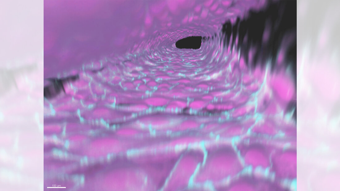 3-D-Rekonstruktion eines im Labor hergestellten künstlichen Hirngefäßes