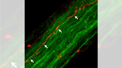 Fasern des Nervus Vagus