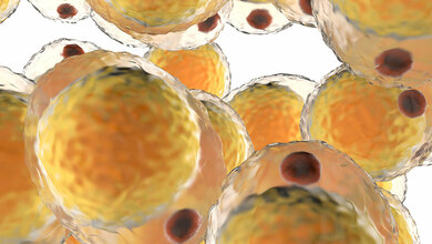 Vergrößerte Fettzellen können Stoffwechselerkrankungen verursachen. 