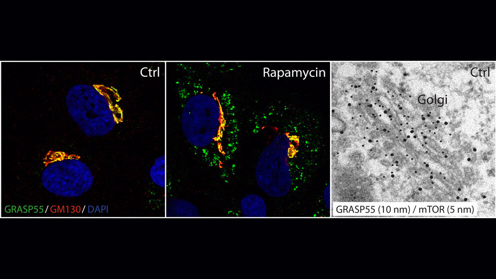 Immunfluoreszens- und elektronenmikroskopische Aufnahmen
