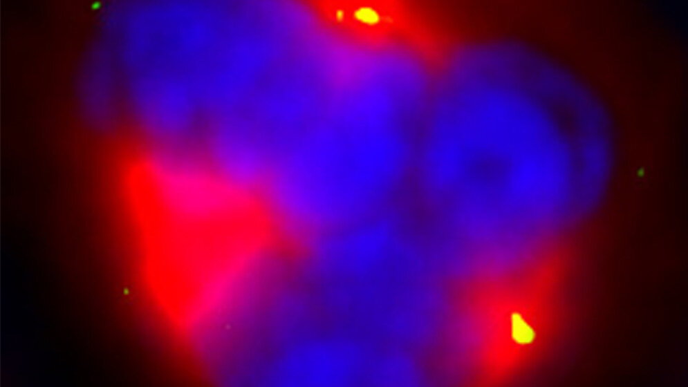 Taxane_Klinikum_der_Universität_München.jpg Taxane