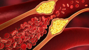 Titelbild des englischen Fachbeitrags über periphere arterielle Verschlusskrankheiten