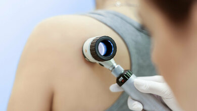 Hautkrebs-Screening.jpg Deutsche kaum Interesse an Hautkrebsfrüherkennung