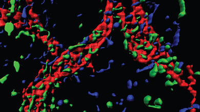 Immunzellen_wandern_auf_Lymphgefaess_rot_zu_Aufnahme_AG_Worzfeld.jpg Immunzellen wandern auf ein Lymphgefäß zu