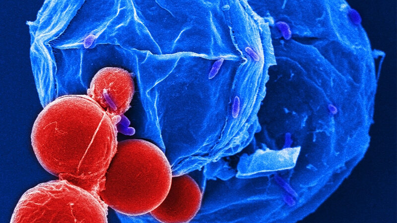 Peroxisomen beim ToxoplasmoseErreger nachgewiesen MTDialog