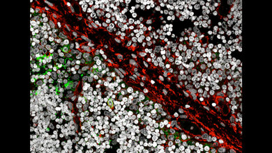 B-Zellen (grün) in Thymusgewebe 