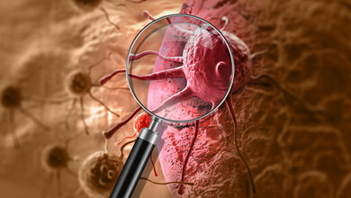 Proteinmuster z.B. bei Krebs untersuchen