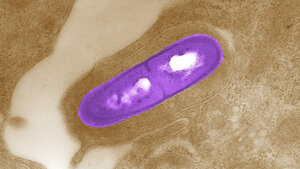 Listeria monocytogenes