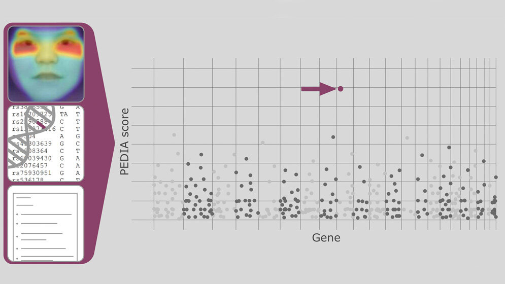 Mit Künstlicher Intelligenz zur Diagnose seltener Erbkrankheiten