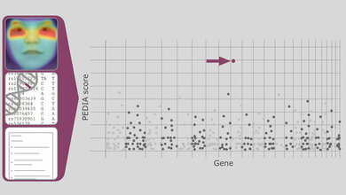 Mit Künstlicher Intelligenz zur Diagnose seltener Erbkrankheiten