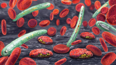 Fallbeispiel Hämatologie – Plasmodium falciparum Titelbild zum Case Report über eine Malariaerkrankung