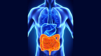 Chronisch entzündliche Darmerkrankungen: Immunmechanismen besser verstehen