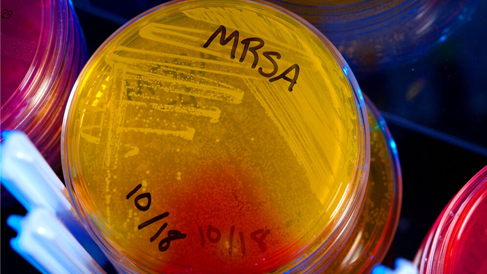 In dieser Petrischale wachsen MRSA-Keime.
