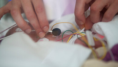 AdobeStock_499003236.jpeg Kleinkind mit EEG