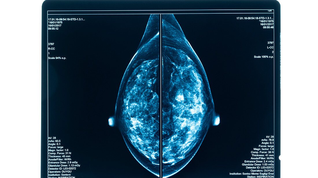 onkologische Studien lassen sich auch mit längeren Erhebungsräumen realisieren