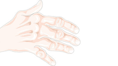 Bildgebende Verfahren Rheumatoide Arthritis