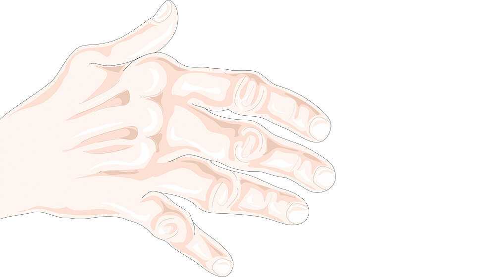 Bildgebende Verfahren Rheumatoide Arthritis