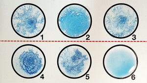 Repetitorium: Partikelverstärkte Agglutination/Latex-Agglutination